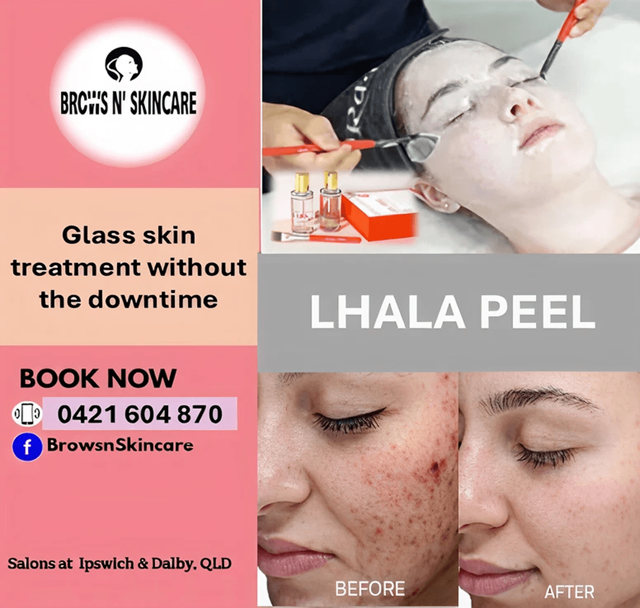 Lhala Peel