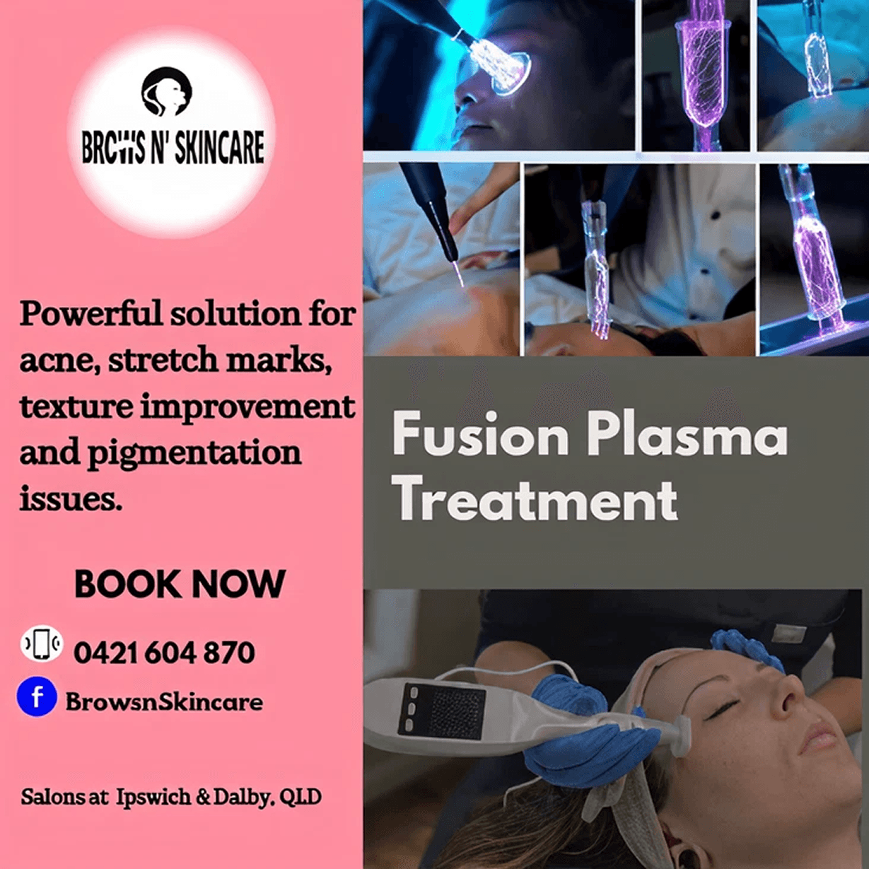 Fusion Plasma Treatment