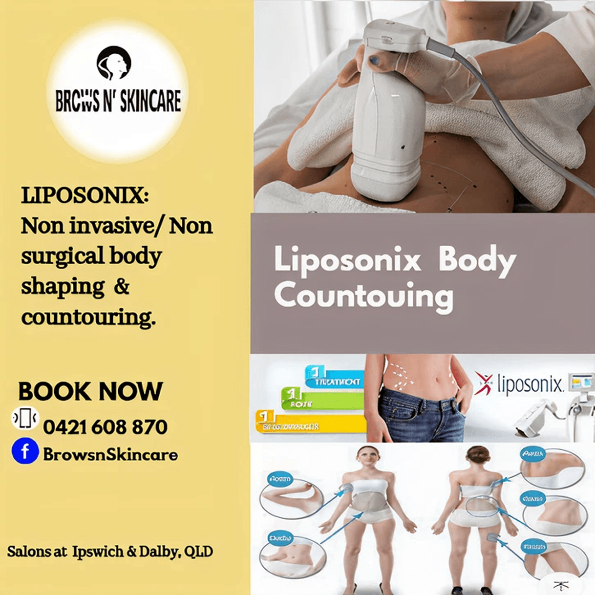 Liposonix Body Contouring