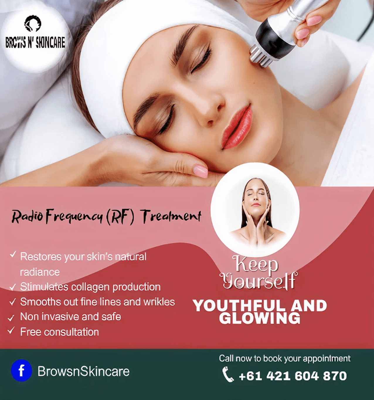Radio Frequency (RF) Treatment